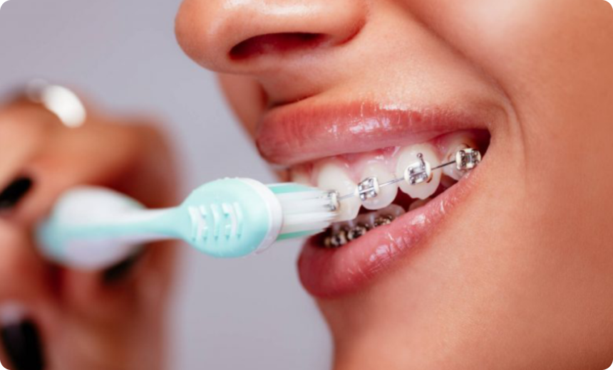 cabinet dentalart greffe sinus nueil les aubiers Hygiène pour les soins orthodontiques Jeunesse