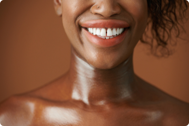 appareils dentaires greffe sinus nueil les aubiers Mauvais alignement dentaire Jeunesse